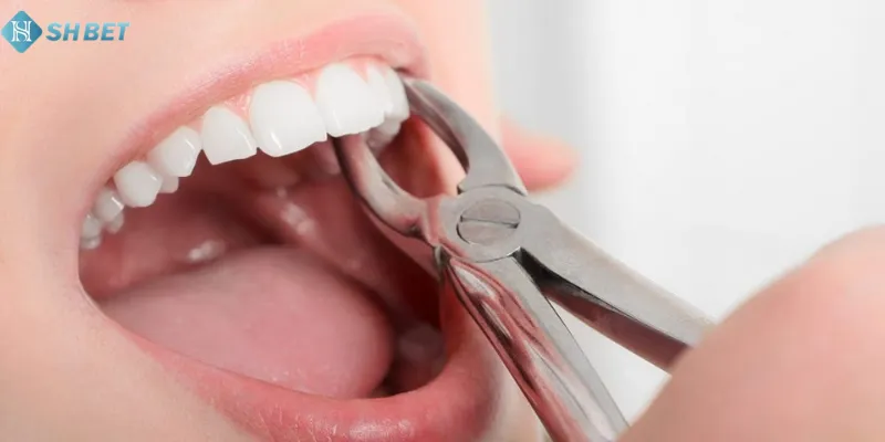 Mơ nhổ răng theo góc nhìn cá cược giải trí