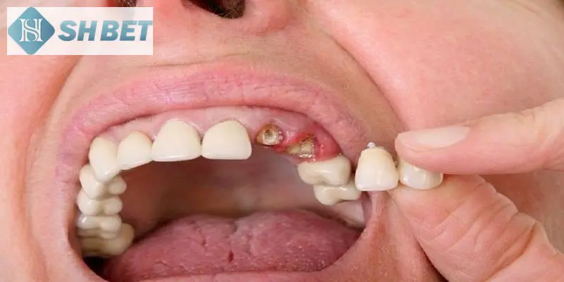 Giấc mơ là gì? cùng SHBET giải mã giấc mơ nhé!